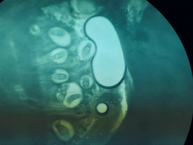 Метацеркарии терматод объединенные в синцисты (Фото С. Власенков)